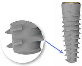 implante dental titanio